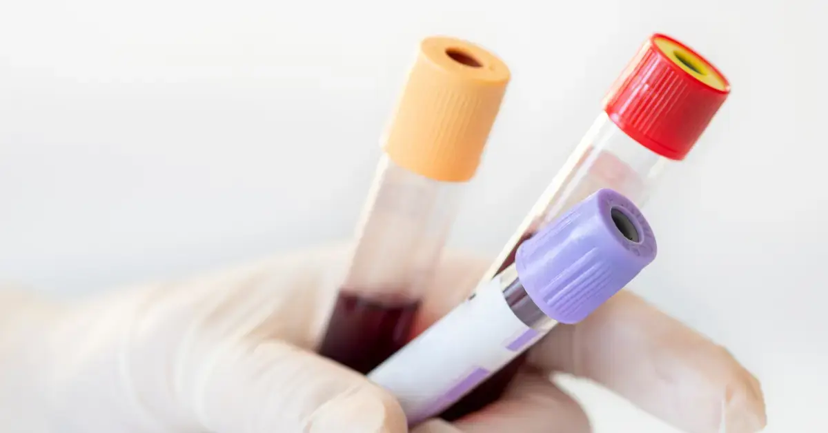 Blutprobenröhrchen in einer Laborhand als Symbol für die Leistungsbewertung, klinische Leistung und regulatorische Anforderungen von In-vitro-Diagnostika (IVD) nach IVDR.